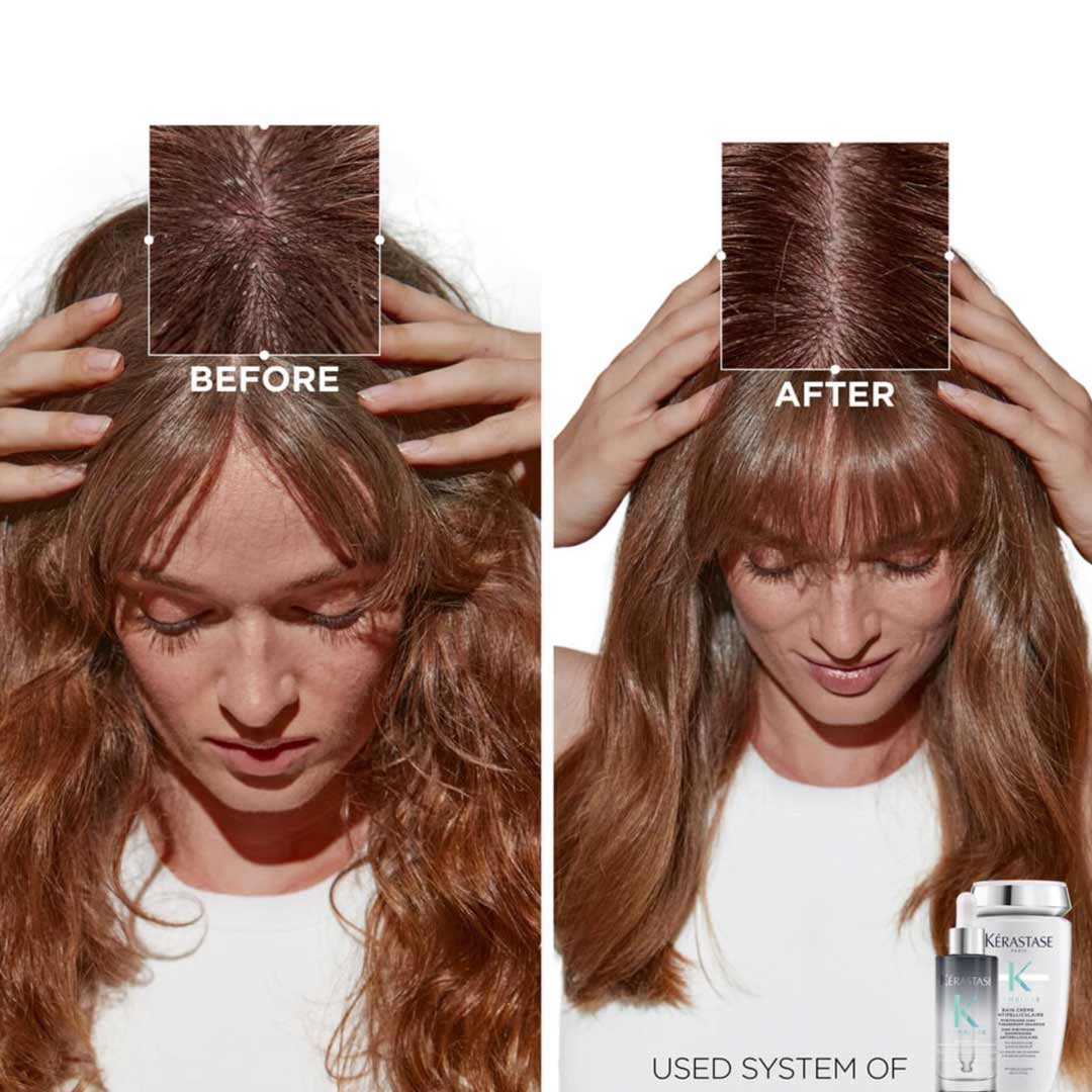 before and after using Bain Crème Antipelliculaire Antidandruff Shampoo