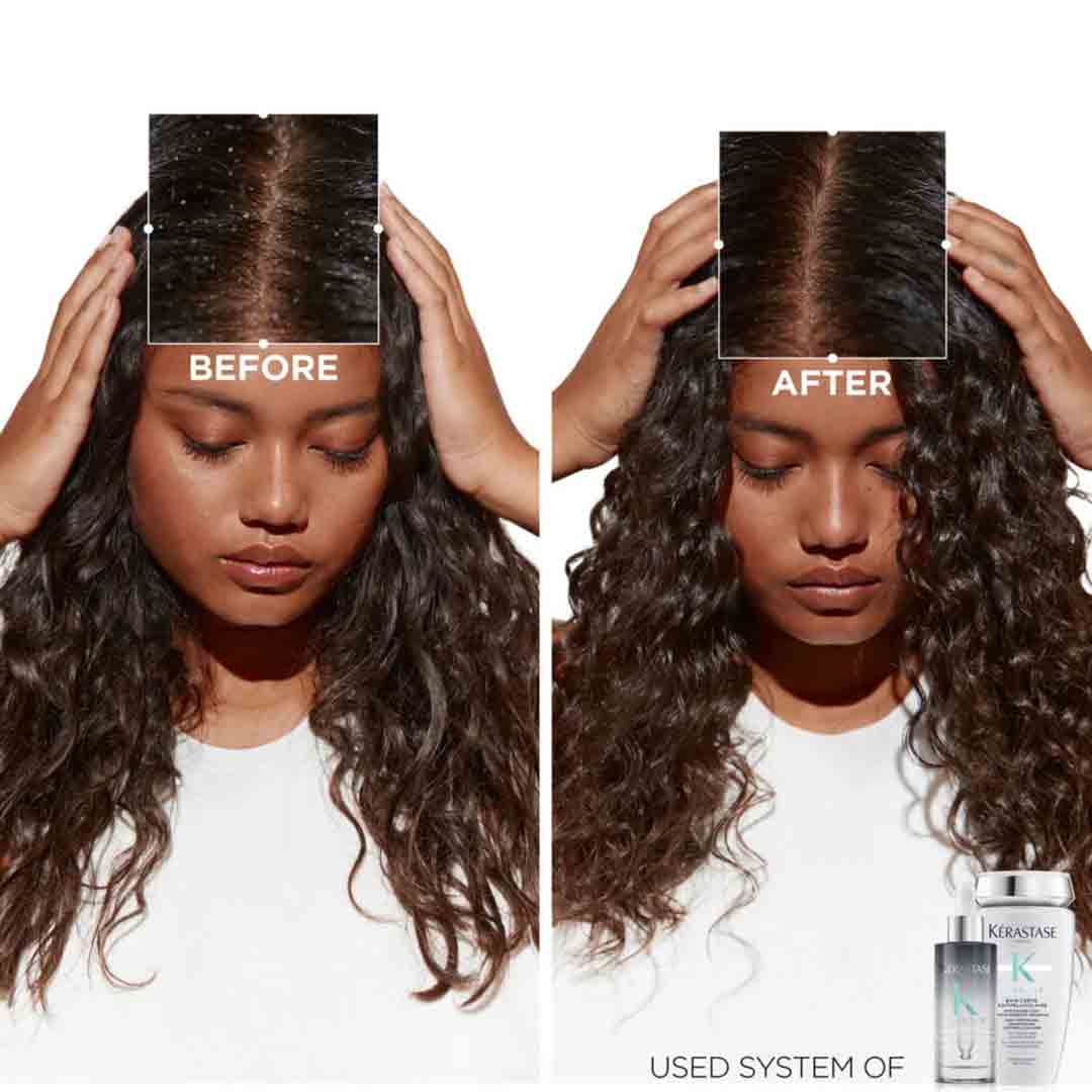 before and after using Scalp Renewal Exfoliating Antidandruff Scalp Scrub