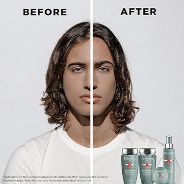 Top Winter Scalp Care Products for Healthy Hair, Salon Ziba